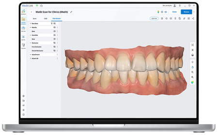 Apple notebook pro Medit intraorální skener