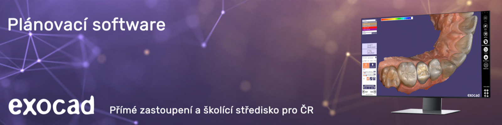 Exocad CAD/CAM software