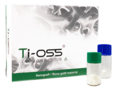 Ti-oss® bovinní granulát 0.5g / 1.5cc(ml), objem 1.5 cm3, velikost zrna 1.2-1.7mm  05-1217